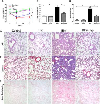 Hyperoside Attenuates Bleomycin-Induced Pulmonary Fibrosis Development in Mice